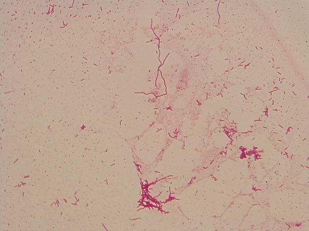 Bacillus Slides - Bacillus 09 1000X